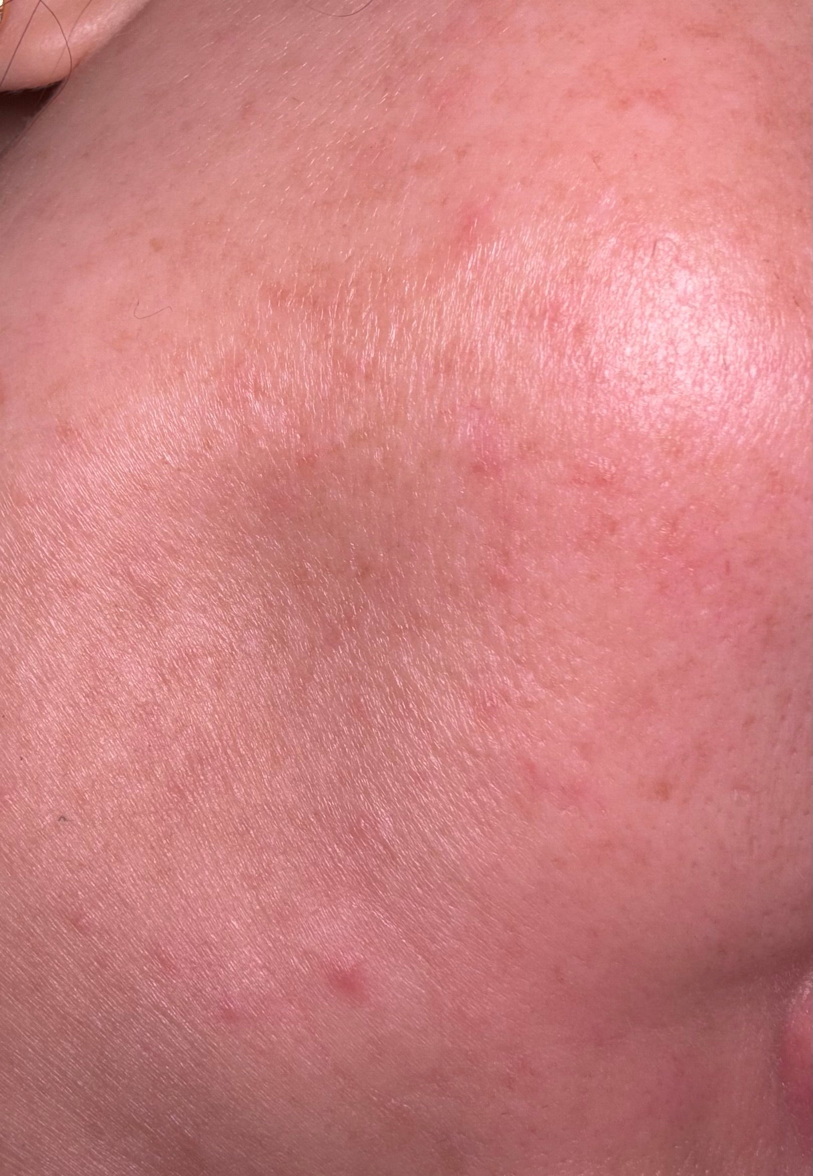 What Is a Lipid Barrier and Why Does Your Skin Need It? - Skin Deep by Lindsey