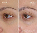 skindeep epicutisskincare epicutis isclinical lipidserum