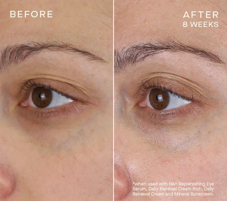 skindeep epicutisskincare epicutis isclinical lipidserum