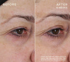 skindeep epicutisskincare epicutis isclinical lipidserum