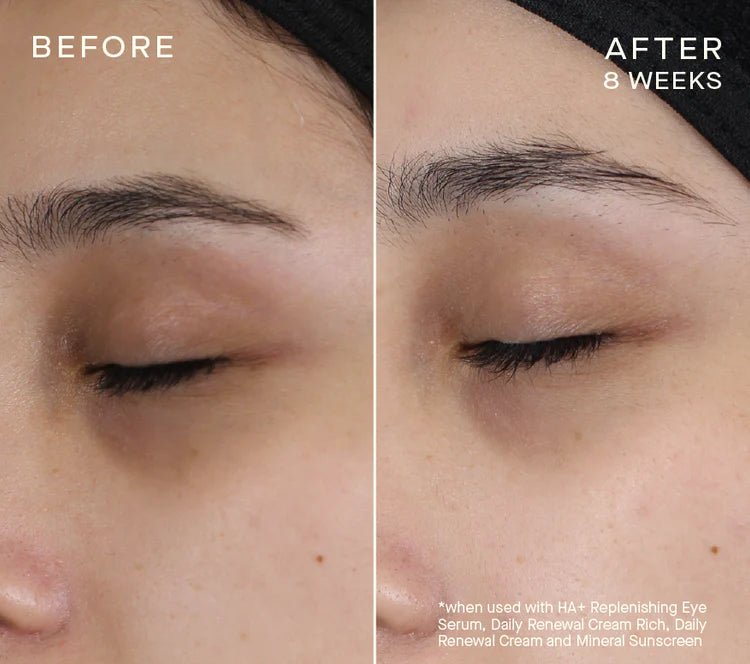 skindeep epicutisskincare epicutis isclinical lipidserum