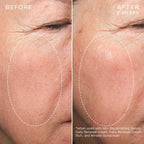 skindeep epicutisskincare epicutis isclinical lipidserum