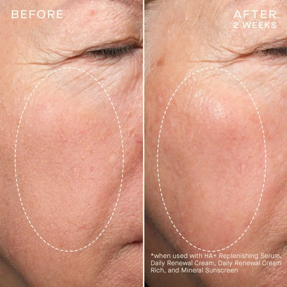 skindeep epicutisskincare epicutis isclinical lipidserum