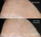 skindeep epicutisskincare epicutis isclinical lipidserum