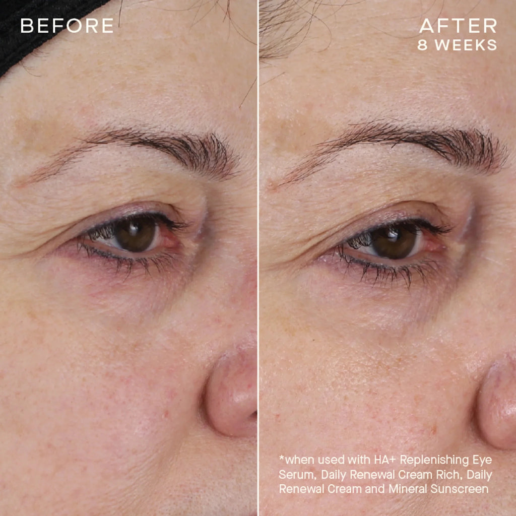 skindeep epicutisskincare epicutis isclinical lipidserum
