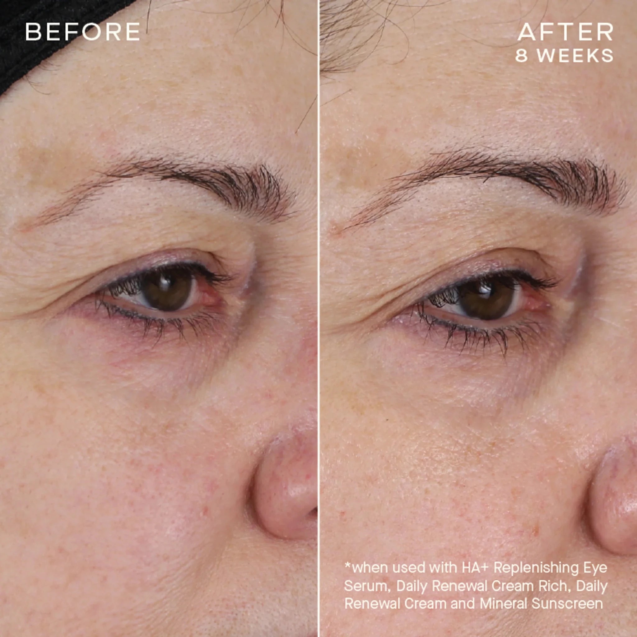 skindeep epicutisskincare epicutis isclinical lipidserum