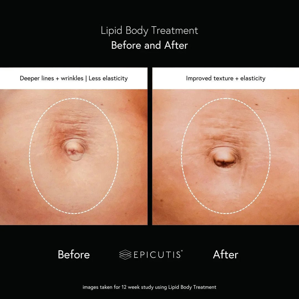 skindeep epicutisskincare epicutis isclinical lipidserum