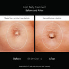 skindeep epicutisskincare epicutis isclinical lipidserum