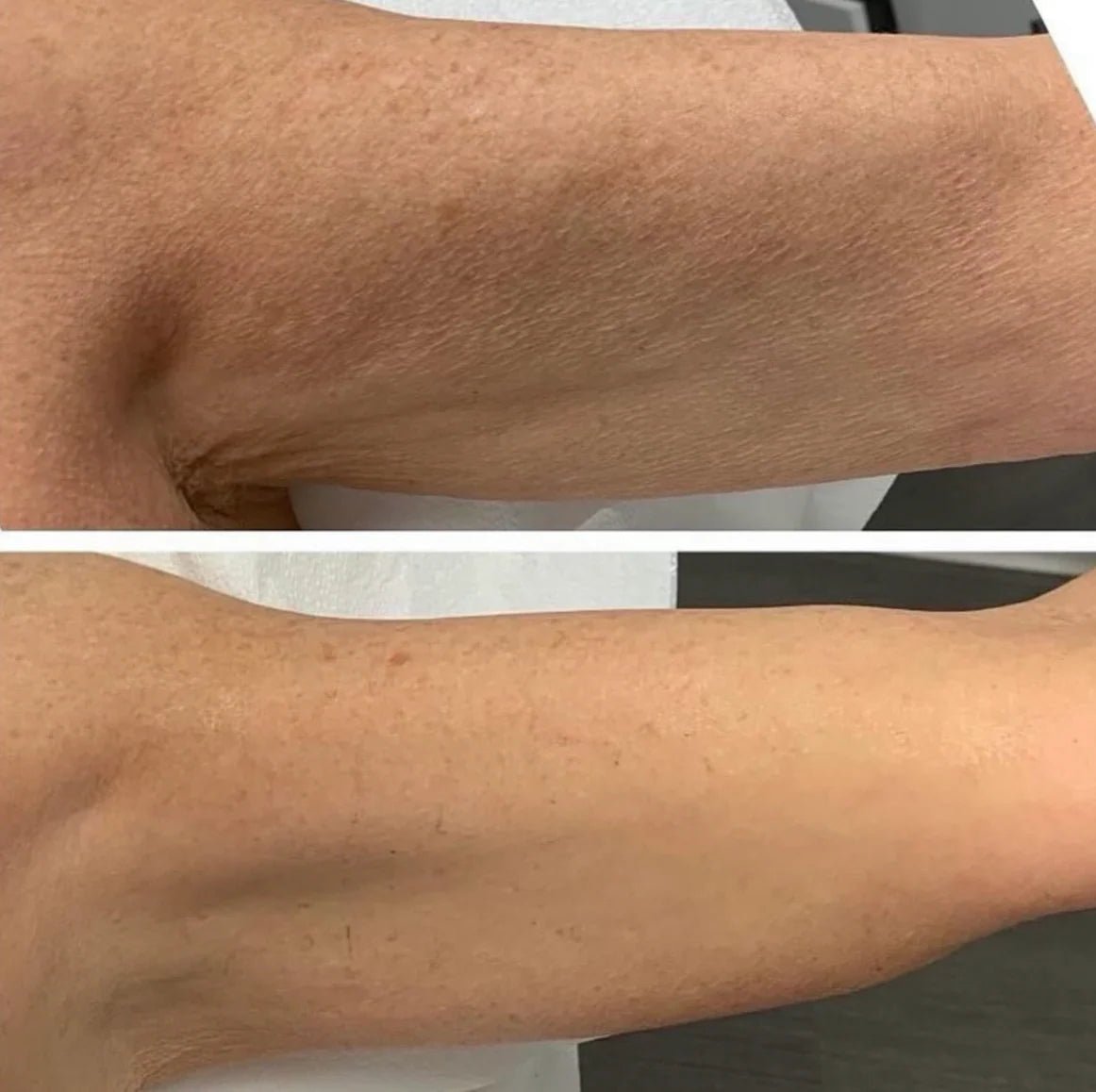 skindeep epicutisskincare epicutis isclinical lipidserum